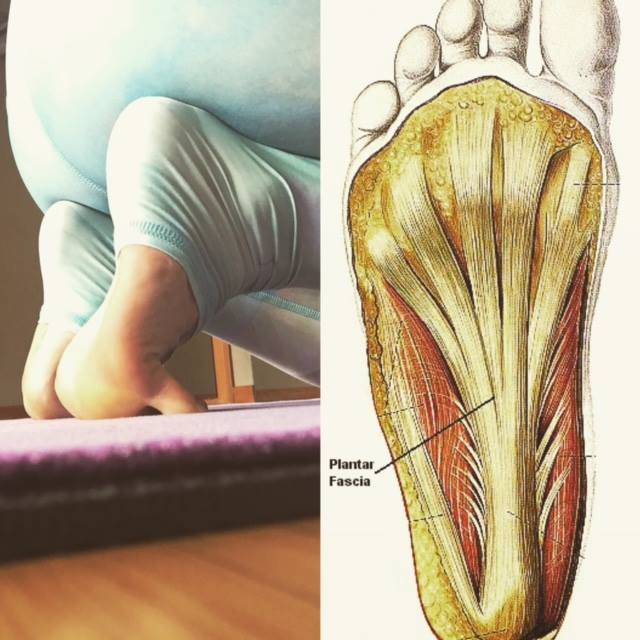 Plantar Fascia Diagram